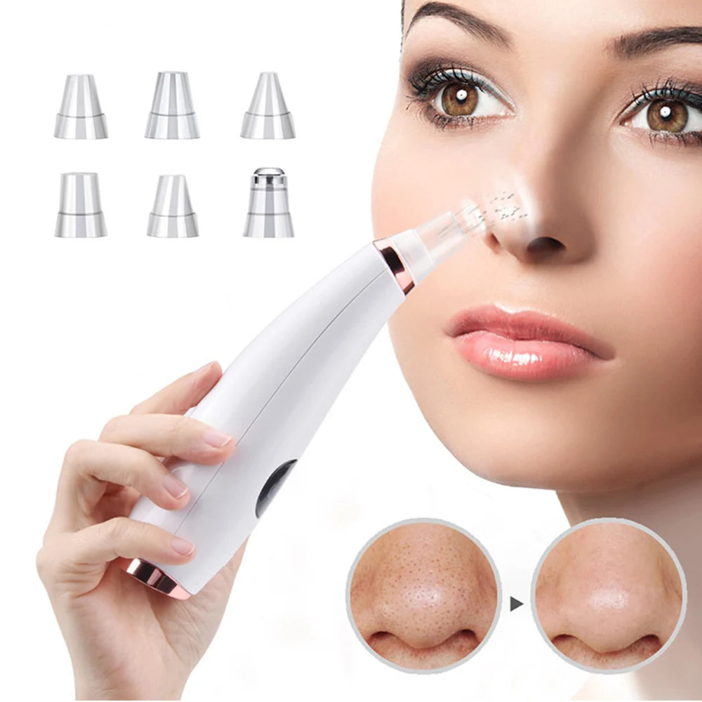 Electric Blackhead Remover Vacuum Acne Cleaner