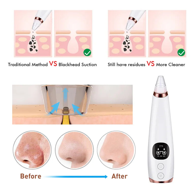 Electric Blackhead Remover Vacuum Acne Cleaner